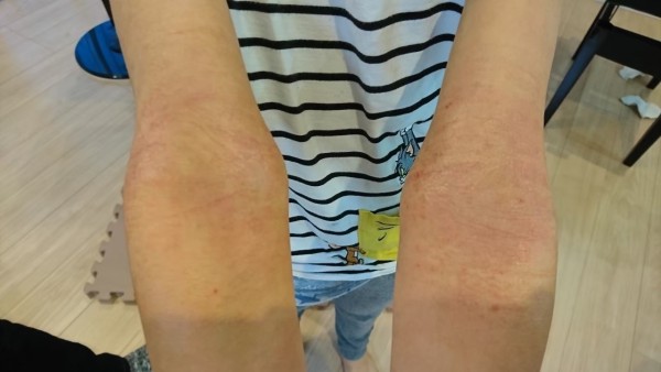 【体験談】アトピーと喘息の息子さんに起きた変化とは？ 画像05