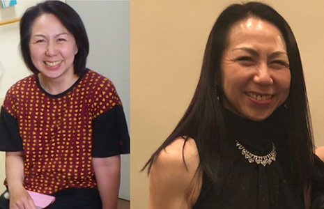 腸を綺麗にすると若返る